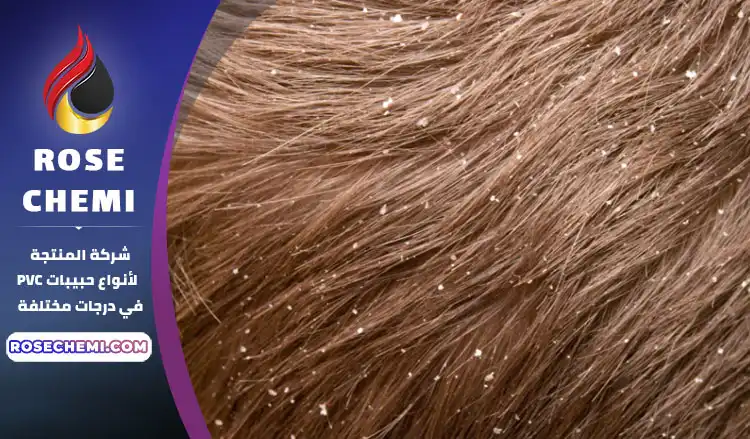 علاج قشرة الرأس