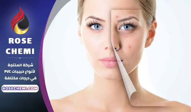 منع ظهور حب الشباب والبقع على الوجه