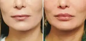 وازلین جهت برجسته سازی پوست